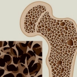 bone diseases-e14fc0536ffce282bf3b40e6716f49b6.jpg